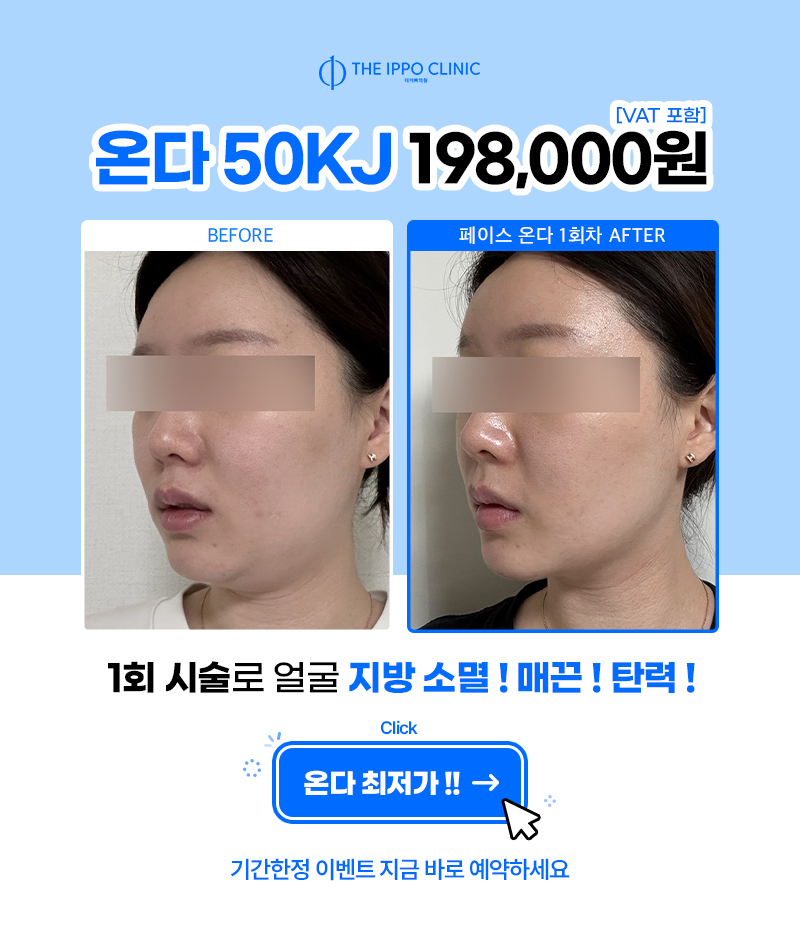 더이뻐 온다 이벤트